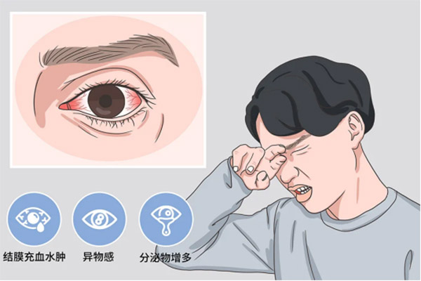 次氯酸治療細菌性和病毒性結(jié)膜炎